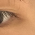 [댓글부탁해] <b>뒤밑</b>트임 할까 말까