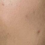 [꼭조언부탁] 피부 <b>상태</b> 심각한가요 25살입니다
