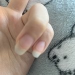 머리카락은 ㅈㄴ 늦게 자라는데 <b>손톱</b>은 왤케 빨리 자라는 걸까