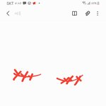 쌍수 ㄹㅇ 후기