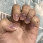 나 <b>손톱</b> 왜 보라색이냐̑̎?̊̈