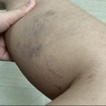 (혐짤주의) 어제 엄마한테