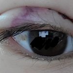 [조언부탁해] 앞트망한것같음ㅠㅠㅠㅠㅠ *사진혐주의