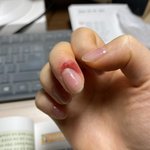 [드루와] 나 <b>손톱</b> 위 살 뜯은 것 좀 봐..