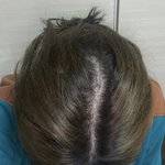 [이것좀봐줘] 나 탈<b>모야</b>?