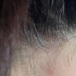 [드루와] 목에 이거 뭐야??