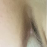 [드루와] 나 눈<b>착색</b> 오짐