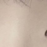 [드루와] 쌍수 할 애들 들어와 후기 알려줌 1 사진있음