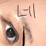 [드루와] +댓글 내가 안썼어ㅠㅠ//쌍수 후기 들고왔어2 수술 후...