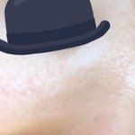 이거 피부<b>요철</b> 맞아? 사진 주의