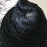 [댓글부탁해] 나 <b>탈모</b>야?? 들어와봐ㅜ