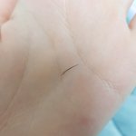 [이것좀봐줘] 얘들아 속눈썹도 탈모가 <b>생길</b> 수 있음????
