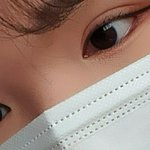 [드루와] 쌍수 <b>절개</b> 2개월차
