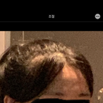 나 <b>이마</b> 넓은건지 좁은건지 좀 알려주라