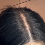 내 정수리 보기 흉하지