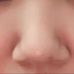 [댓글부탁해] 나 코성형 진짜 하고싶은데