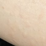 얘들아 내 종아리 갑자기 왜 <b>아래</b>???(약혐