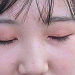 [뷰티] 중3 <b>쌍수</b> 특징 .jpg
