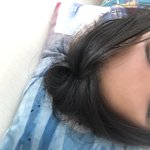 <b>매몰</b> 4일차 붓기 얼마나 더 빠질 것 같애?