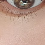 눈 <b>밑</b>에 이거 왜생기는거임?