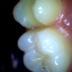 [국민청원좀] 명백한 치과측 의료사고 과실 증명에도 말을바꾼 송파구가락동S치과...