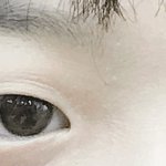 얘드라 나 앞트임 해야 될 거 같아??
