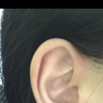 [19] 나 <b>유두피어싱</b> 할건데