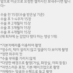 야 <b>쌍수</b>한사진 <b>병원</b>에 보내야되는데