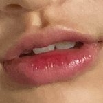 [19] 나 인중 개짧고 ㅈㄴ <b>파임</b>