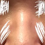 [댓글부탁해] 내 코 <b>복코</b>지??