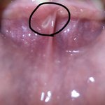 [댓글부탁해] 이거 <b>구내염</b> 맞지?