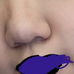 나 코성형 해야겠지 ㅠ ㅠ 사진 ㅇ 블랙<b>헤드</b> 주의