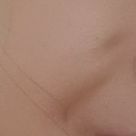웃을 때 이 <b>주름</b>은 뭐임?