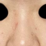 [댓글부탁해] 이 정도면 복코 <b>쉐딩</b> 앵간..?.?.?.?.