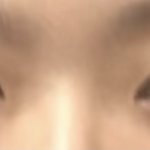 [댓글부탁해] 얘들아 나 쌍수할까말까 <b>일생</b>일대의 고민임