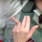 전세계 인구 3%만 가능하다는 손가락<b>꺾기</b>