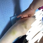 같은 제 친구 할머니가 노인 <b>폭행</b>을 당하셨어요. 제발 도와주세요...