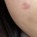 이거 <b>개학</b> <b>전</b>에 없앨 수 있겎지..??