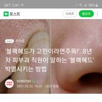 [드루와] 이거 판녀<b>글</b> 아님? 언제 8년차 피부과 <b>직원</b>됐냐