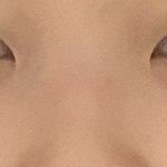 내 코 좀 <b>보</b><b>셈</b> 수술할까