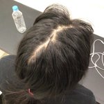 얘들아 내 친구 나 탈모 갖고놀려