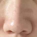 [이것좀봐줘] 나 <b>복코</b> 많이 심해?