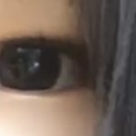 쌍수한지 일주일 됨