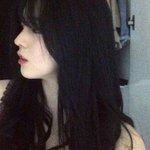 이거 <b>자국</b> 치료 받아야함? (혐주의)