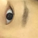 너네가 나면 <b>재수술</b> 한다/안한다