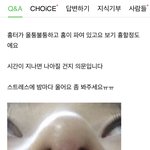 [외모고민] 외모에서 코가 가장 중요한 이유