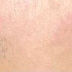 [조언부탁해] <b>눈썹</b> 정리했는데 어때 괜찮아???
