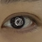 쌍커풀 <b>재수술</b>할까