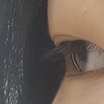 [댓글부탁해] 다이어트하면 눈두덩<b>살</b>도 빠져??