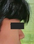 [댓글부탁해] 아들 코성형이 필요한가요?